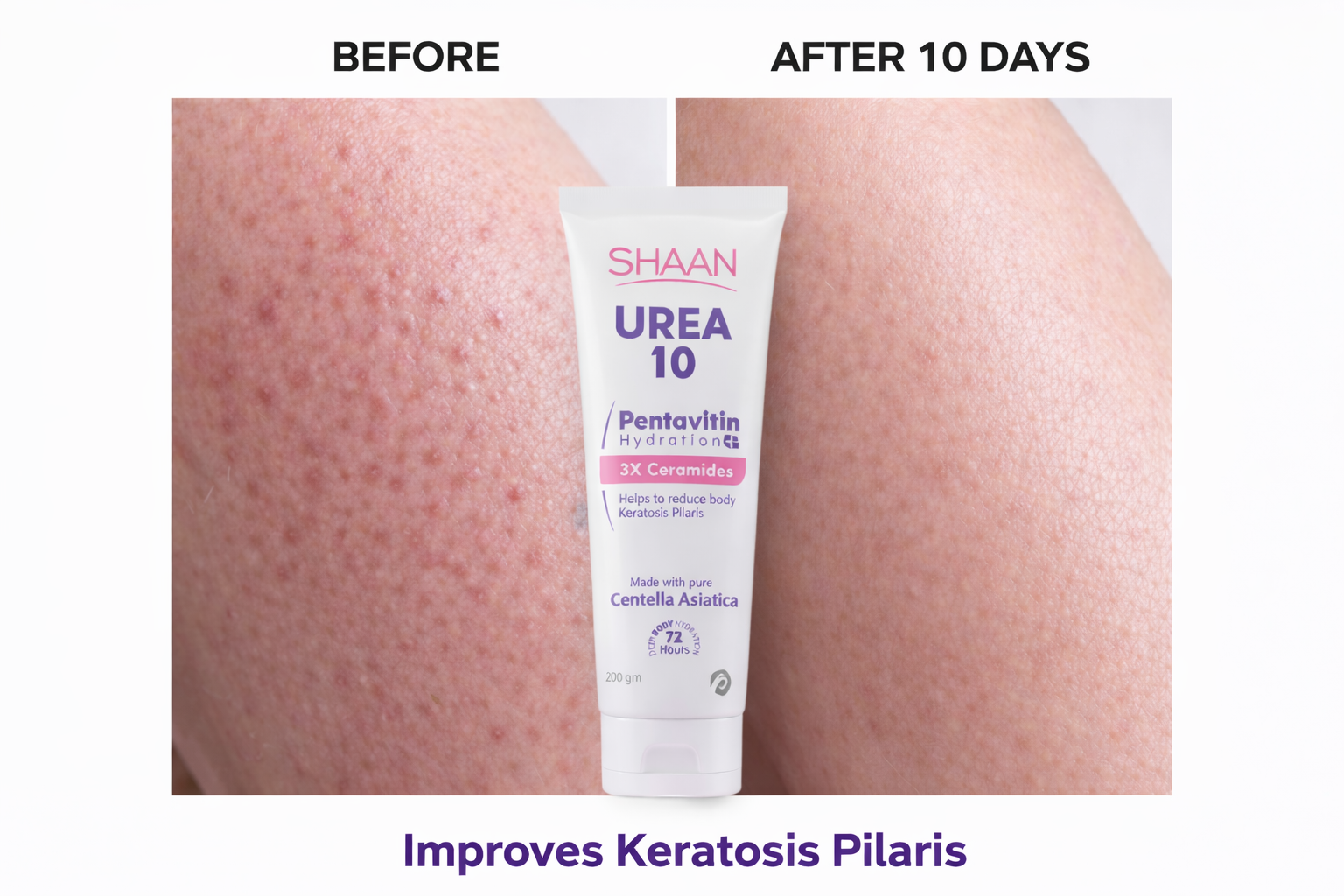شان كريم مرطب للجسم يوريا 10% 200 جم