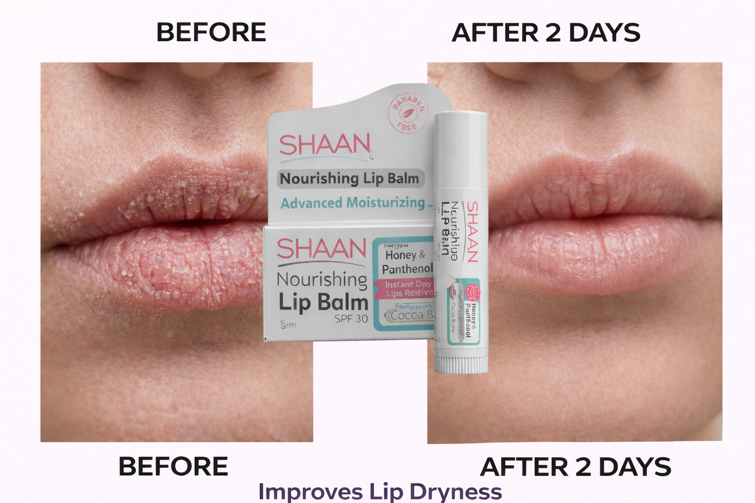 Shaan Lip Balm SPF 30 5 gm