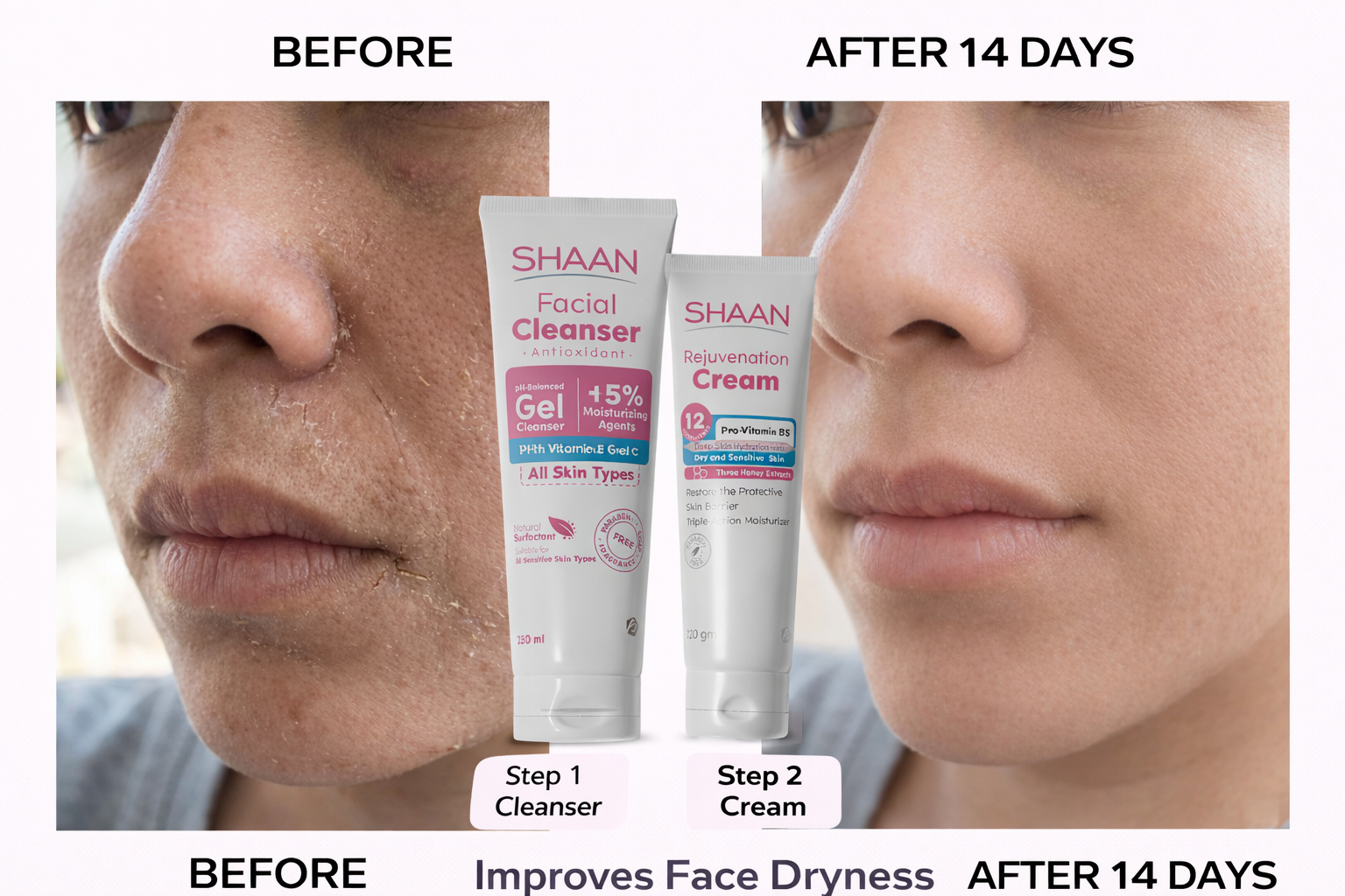 Shaan Rejuvenation Cream 120 gm