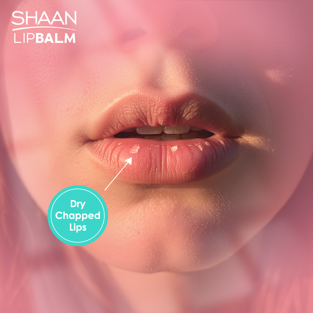 Shaan Lip Balm SPF 30 5 gm