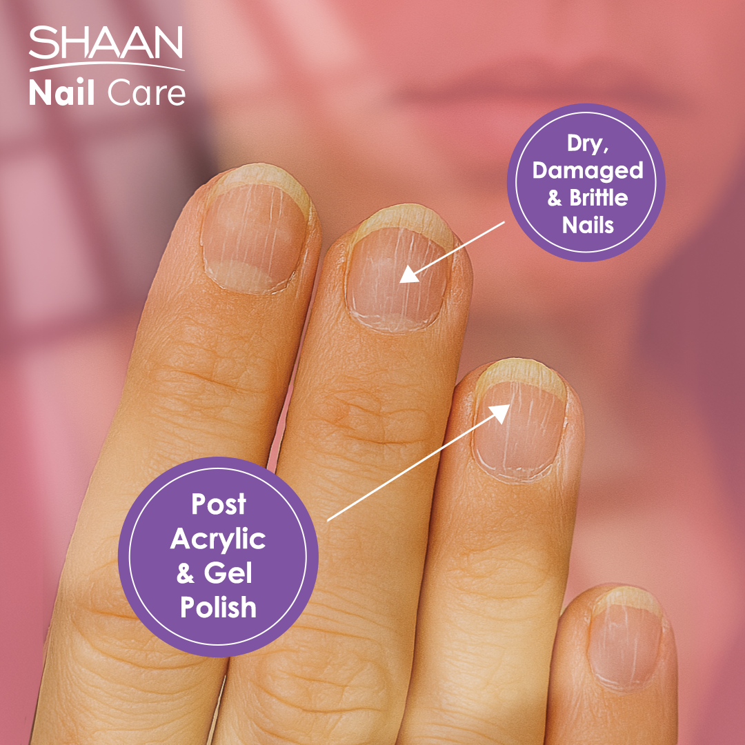 Nail care product advertisement showing dry, damaged, and brittle nails with 'Shaan Nail Care' branding.