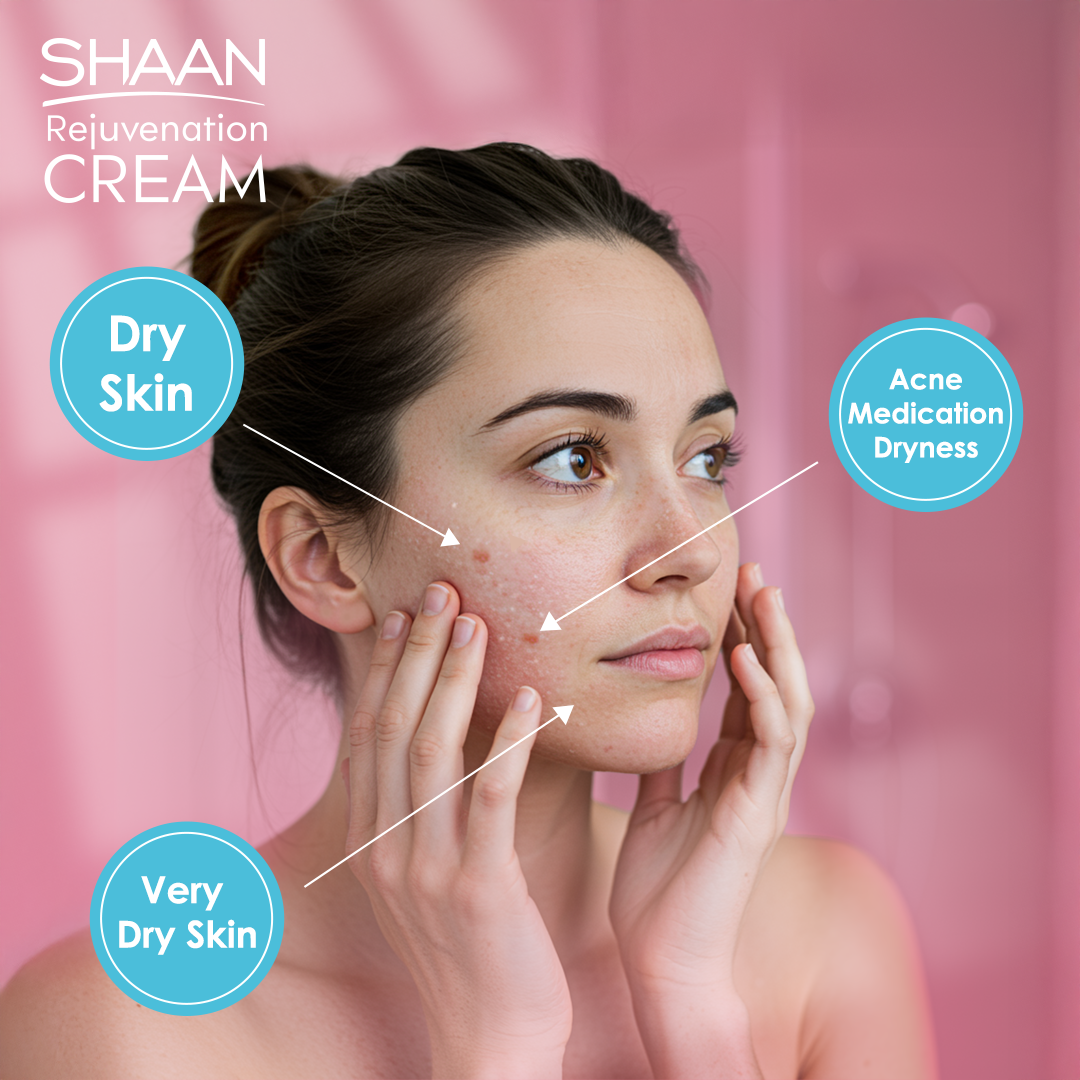 Woman applying SHAAN Rejuvenation Cream with text labels on dry skin, acne medication dryness, and very dry skin.