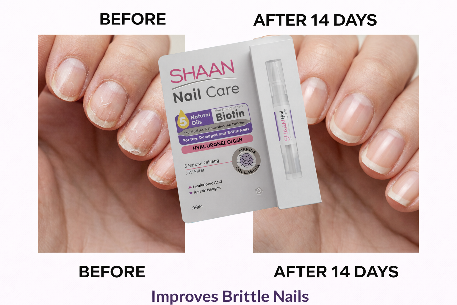 Shaan Nail Care 4 ml